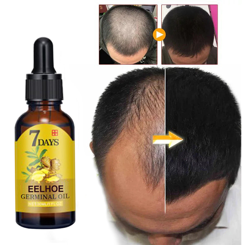 EELHOE Ginger Hair Treatment 20ml Hair Nourishing Hair Care Moisturizing Hair Care Hair Fixing And Anti-Shedding Nutrient Solution