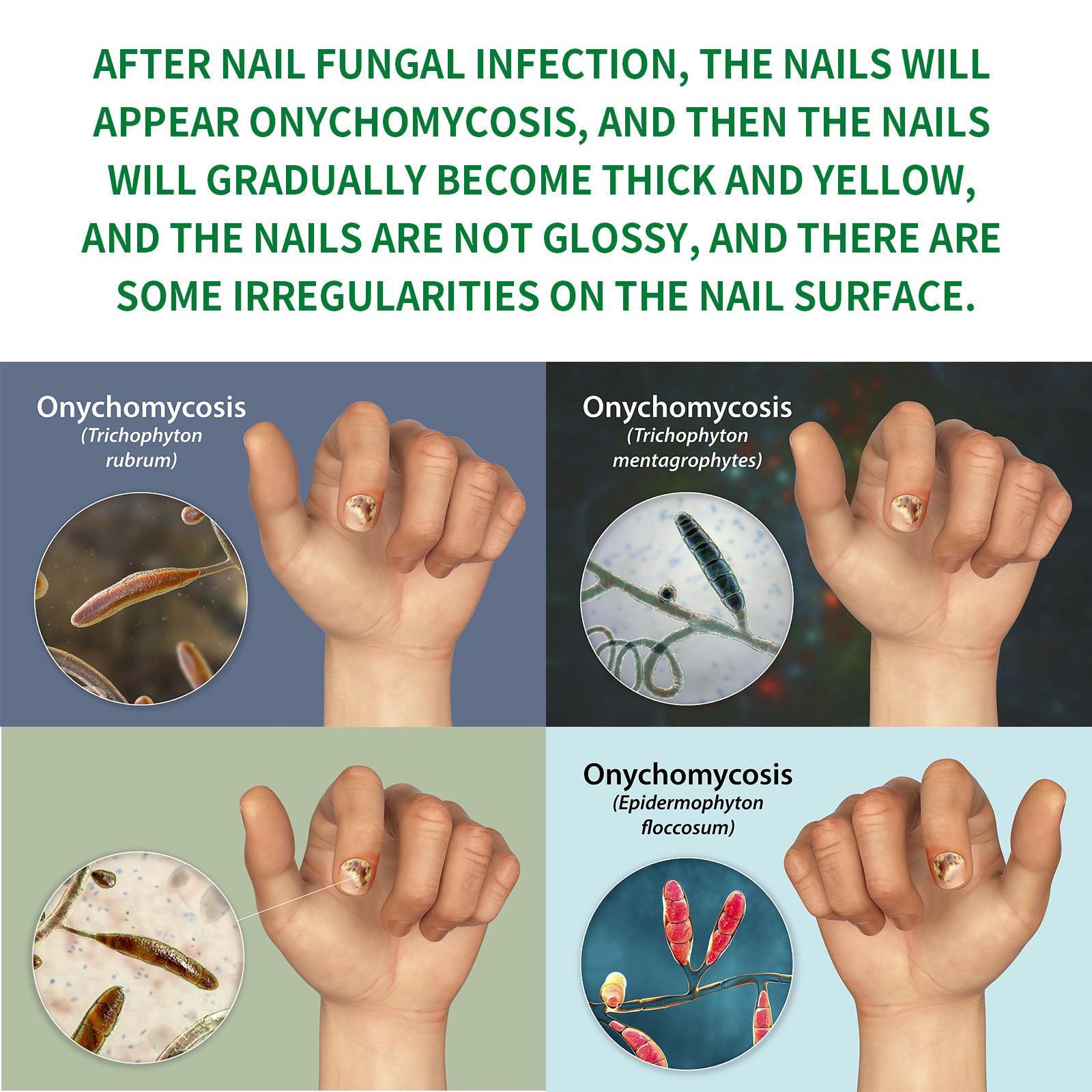 Jaysuing Ginger Nail Care Solution Repair Nails Soft Nail Shine Moisturizing Solution Gray Nails