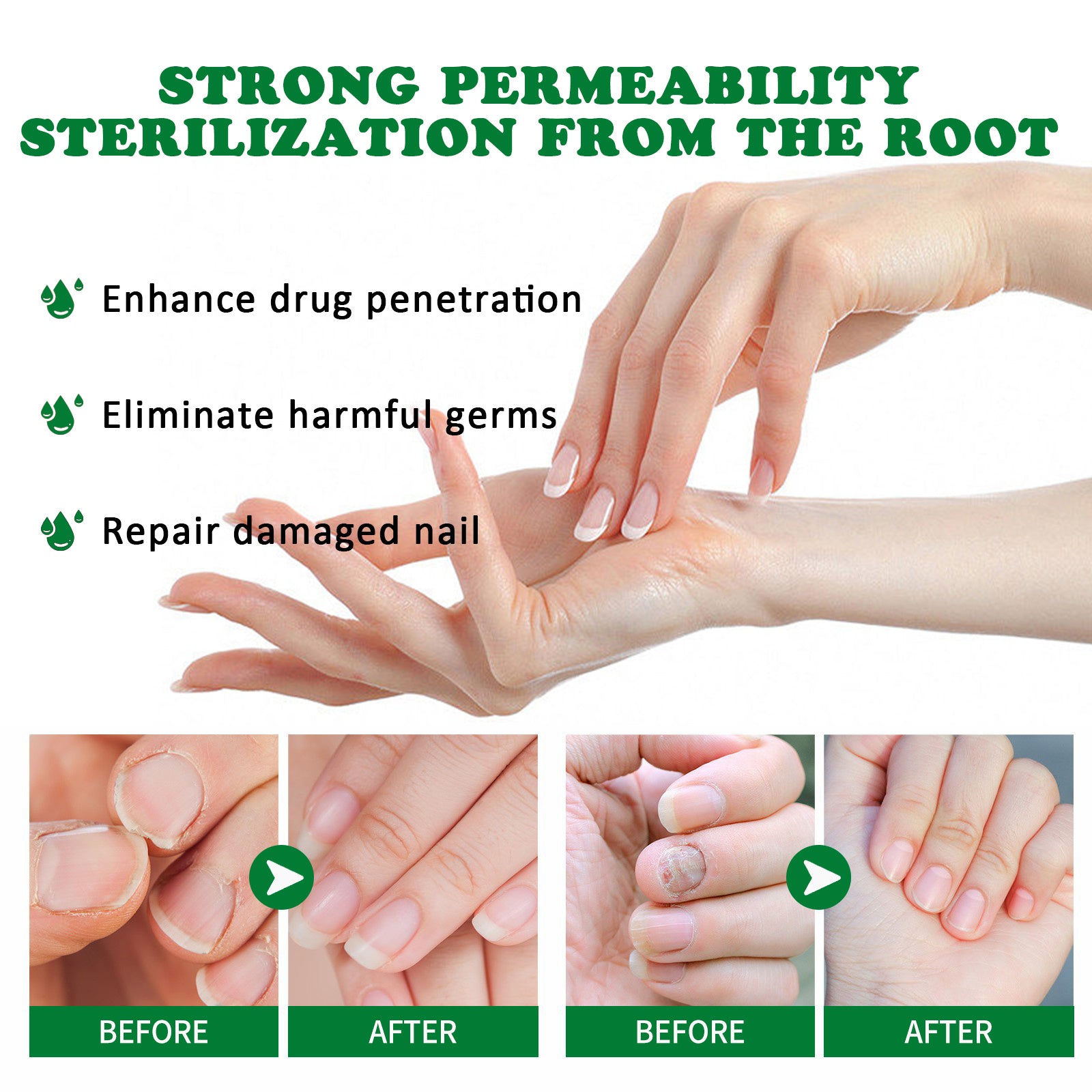 Jaysuing Ginger Nail Care Solution Repair Nails Soft Nail Shine Moisturizing Solution Gray Nails